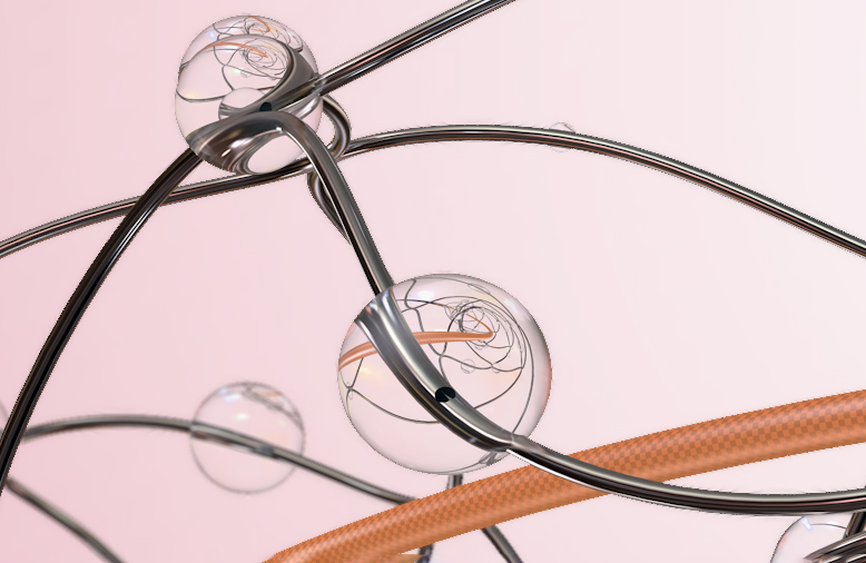 Катетер для тромболізису Flow Medical при тромбоемболії легеневої артерії